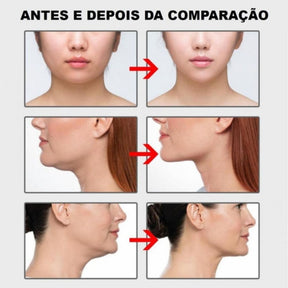 Babe Tape - Face Lifting Instantâneo - Kit com 40 Unidades + Curso Digital Grátis: Alimentação Rejuvenescedora