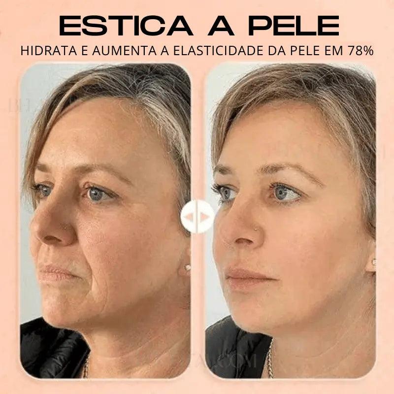 Bastão Hidratante Facial Anti Rugas: Pele Nova e Bem Cuidada